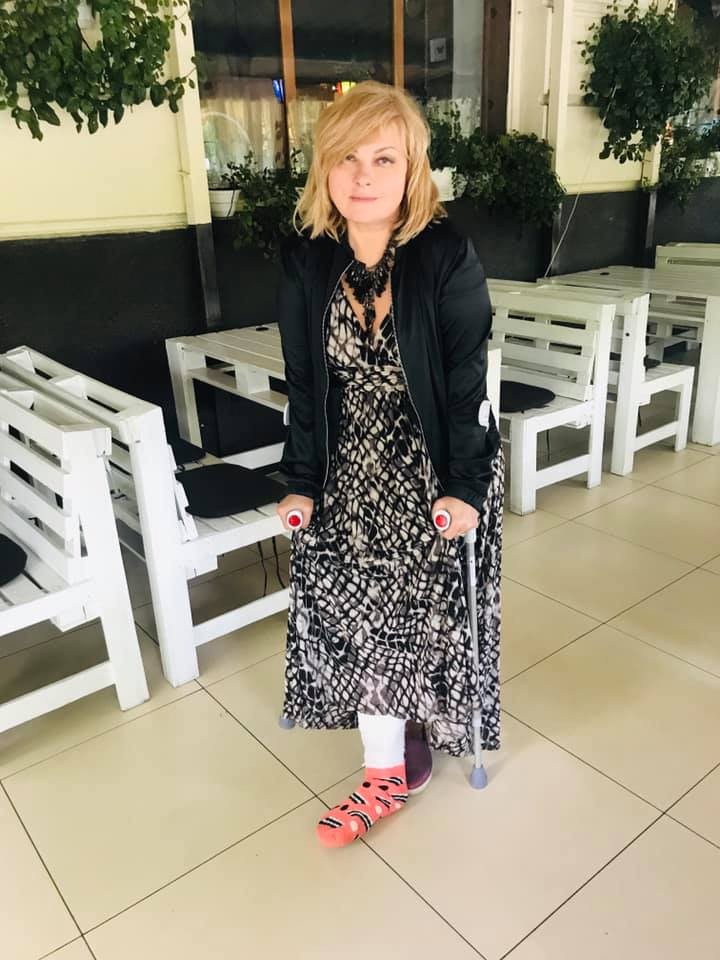 Украинская певица Мария Бурмака сломала ногу