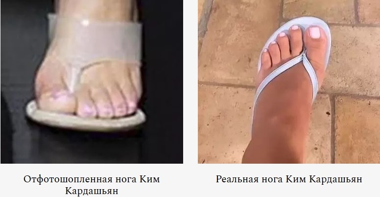 Ким Кардашьян объяснила, почему на фото у нее 6 пальцев на ногах