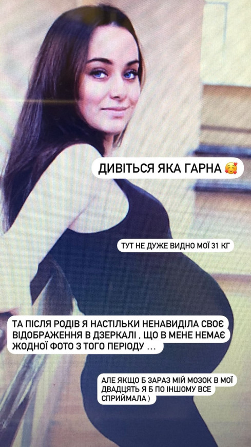 Мішина показала себе у вазі +31 кг під час вагітності 