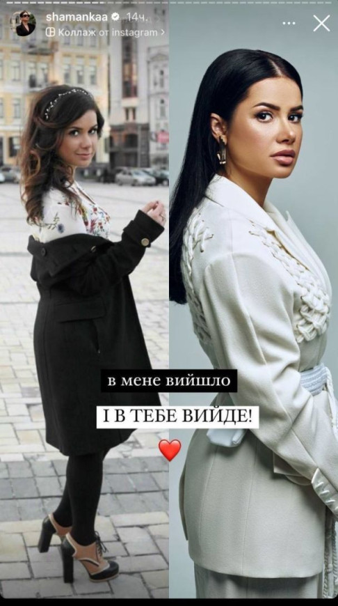 Аліна Шаманська показала, який вигляд мала до пластичних операцій