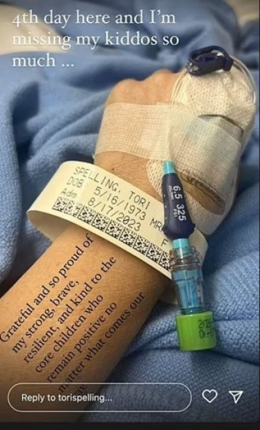  Зірка "Беверлі-Гіллз" Торі Спеллінг із синцями та в інвалідному візку нажахала зовнішнім виглядом 